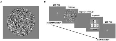 Associations Between Binocular Depth Perception and Performance Gains in Laparoscopic Skill Acquisition